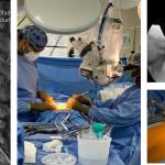 Benefits of Minimally Invasive Spine Surgery for Faster Recovery